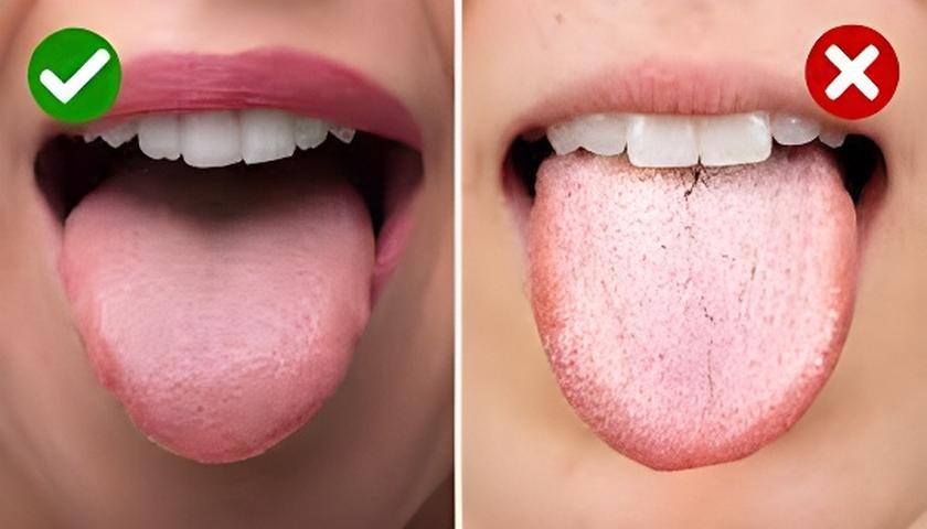 ڕەنگی سپی زمان ئاماژە بە چی دەکات؟